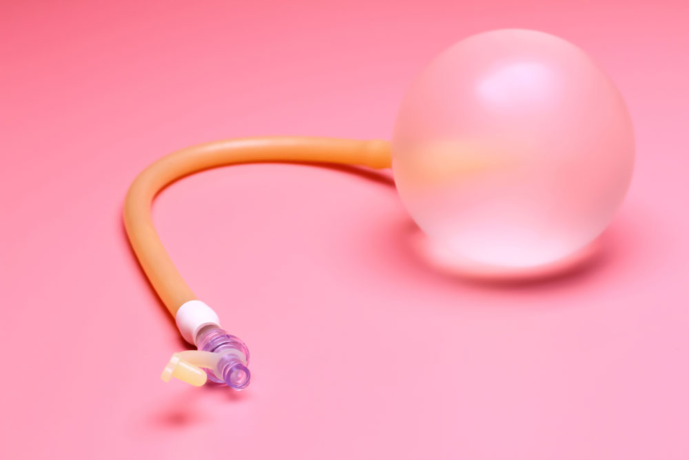 Disposable balloon cervical dilator